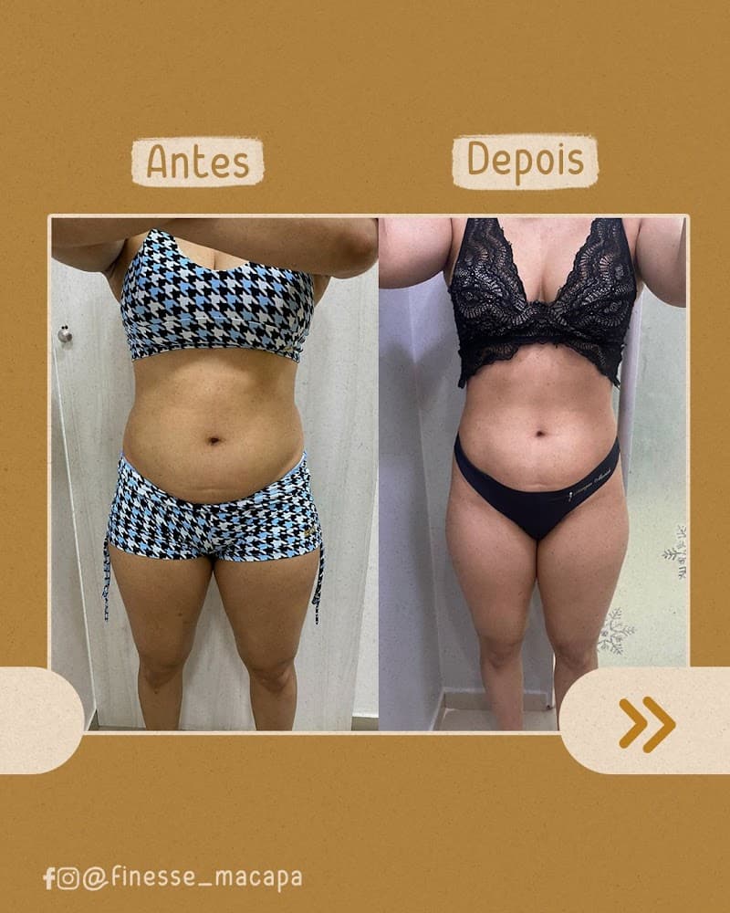 Defyne Fisioterapia Estética Macapá photo