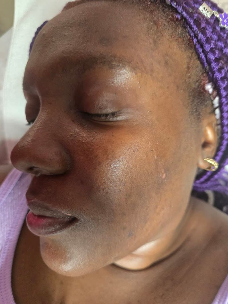 Derma Heavenly Center Worcester photo