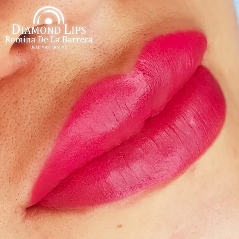 DermoCare Estética y Armonización Facial Lurigancho photo