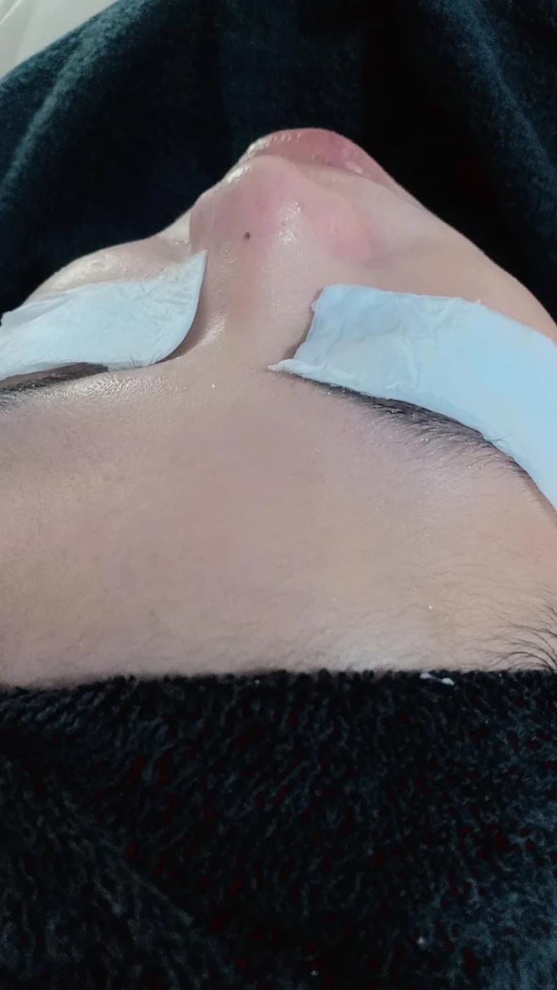 Devi Ade Beauty Aesthetic Batu Bara photo
