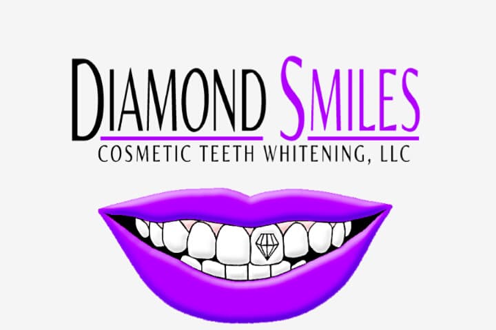 Diamond Smilez Teeth Whitening Spa Vestavia photo