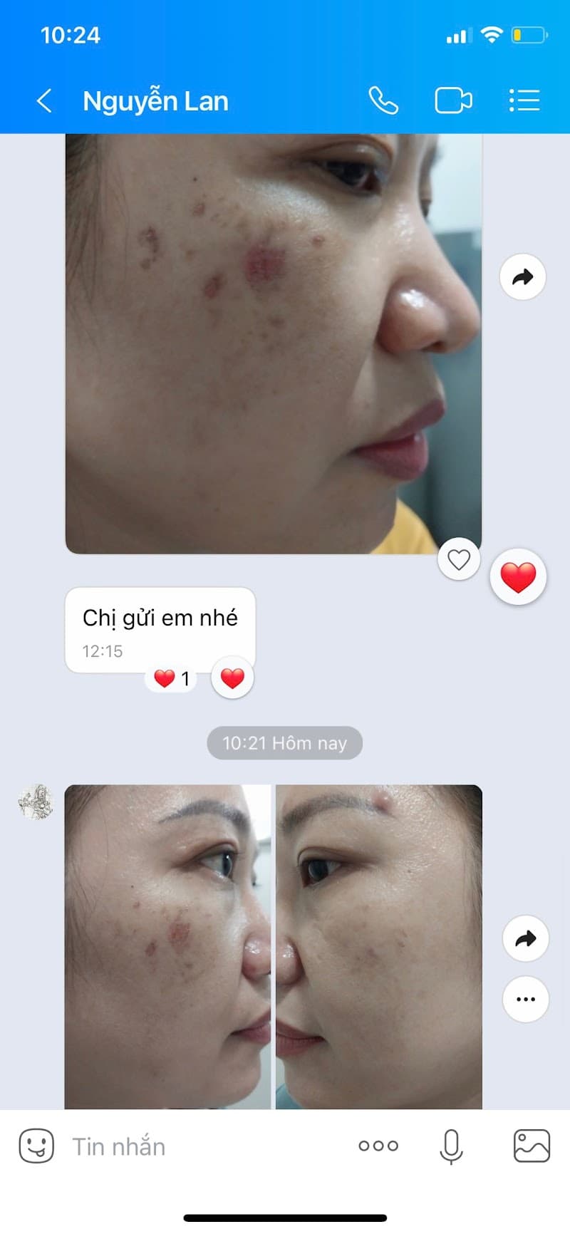 Dr.Anmytas Hệ Thống Spa Tiến Sỹ Da Liễu - Cơ Sở TP Vinh photo