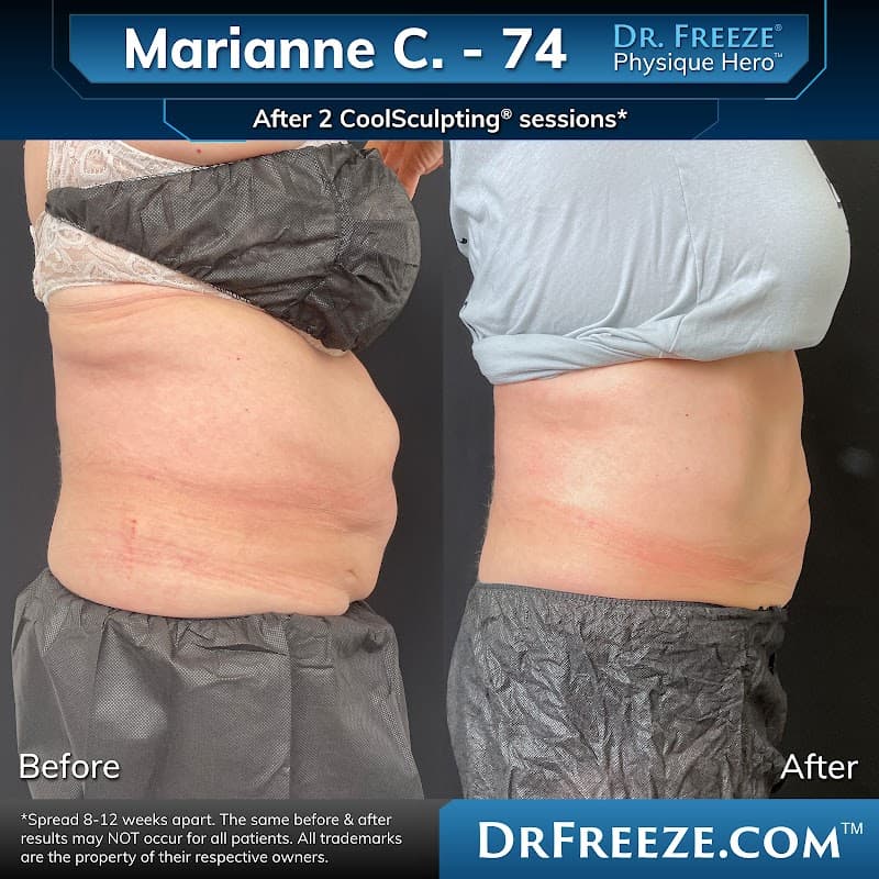 Dr. Sculpt Body Contouring - San Diego photo