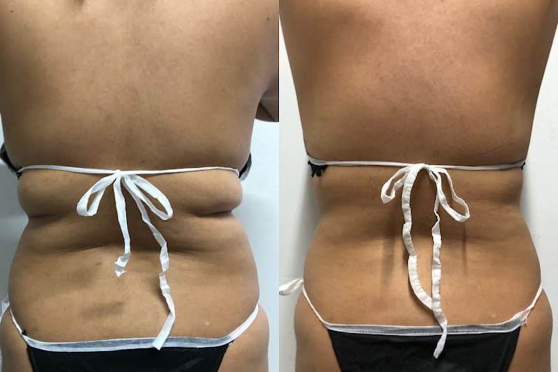 Elite Centro de Estetica y Bienestar Itagüí photo