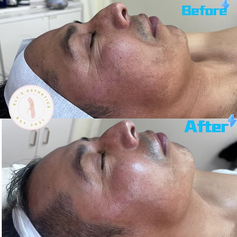 Ely's Esthetics Fresno photo