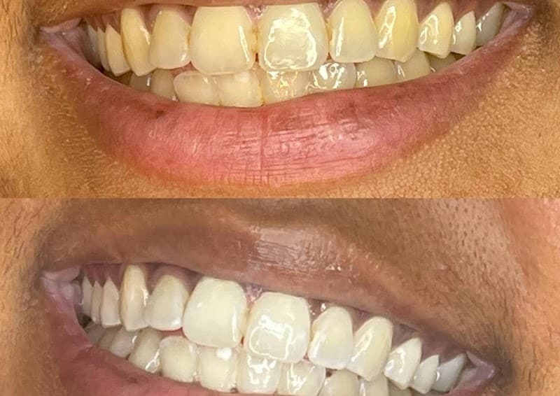 Enchantress Body Sculpting and Smiles Sacramento photo