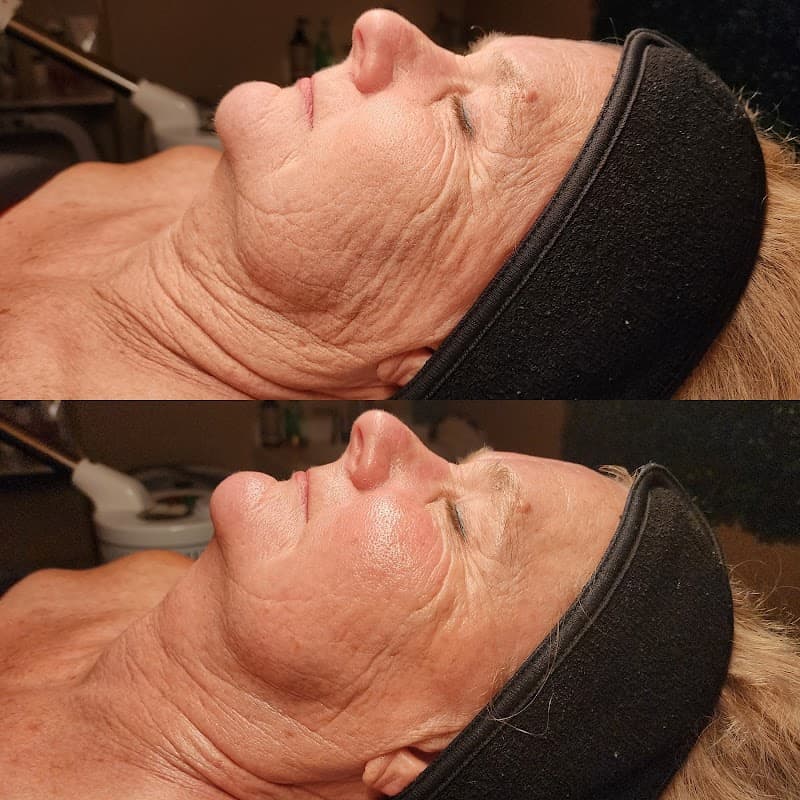 EpidermiSpa Waukesha photo