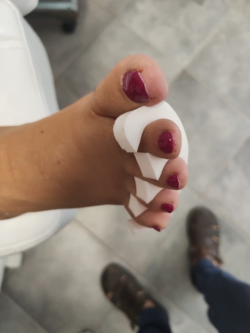 Epilazione Laser Flash X-Press Centro Estetico Ninfea Cecina photo