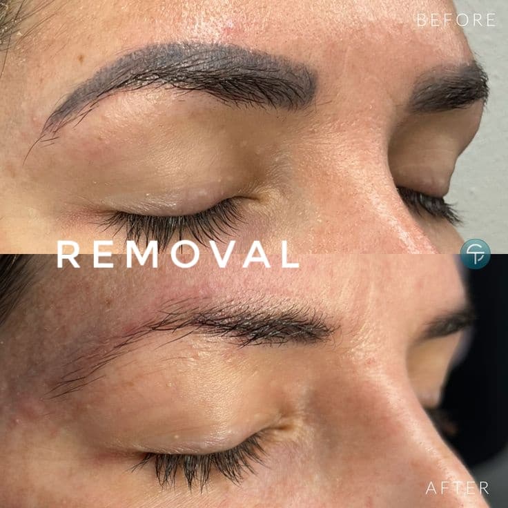EpiZen Skin Health & Beauty Studio Sausalito photo