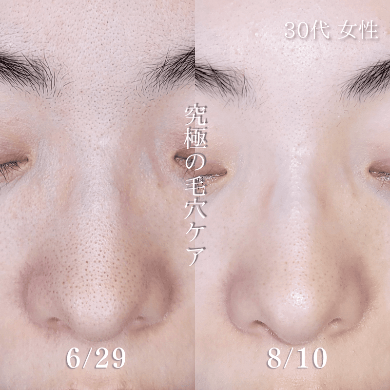 Kobe City Chuo Ward era: kayla - Holistic Beauty Salon. photo