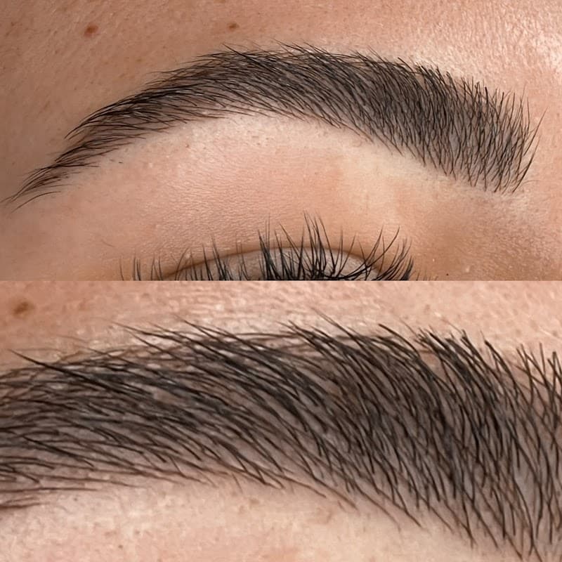 João Pessoa Érica Leite - Clínica Estética photo