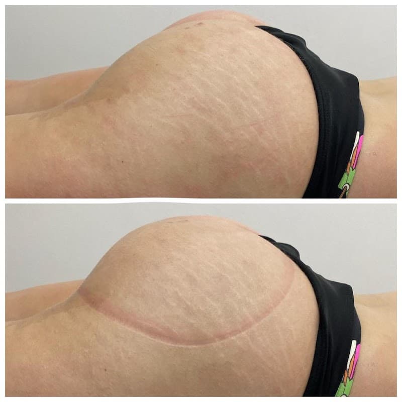 Espaço Estética Tatiane Schumacker Nova Friburgo photo