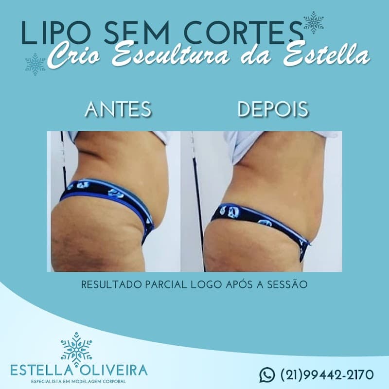 Estela Estética Rio de Janeiro photo