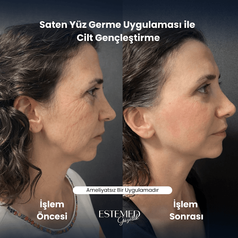 Estemed Guzellik Merkezi Istanbul photo