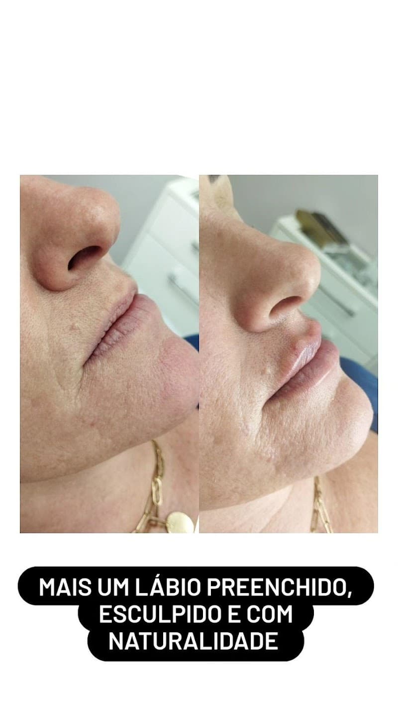 Estética Bem Cuidar Três Coroas photo
