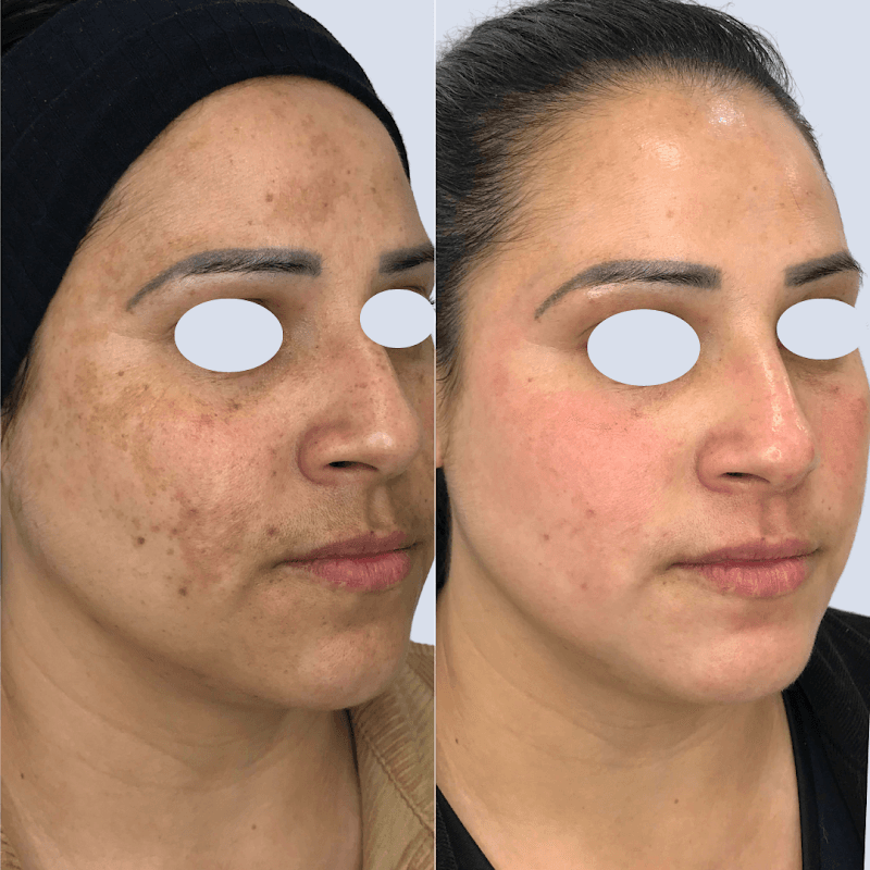 Estética Brenda Maestri Botuverá photo