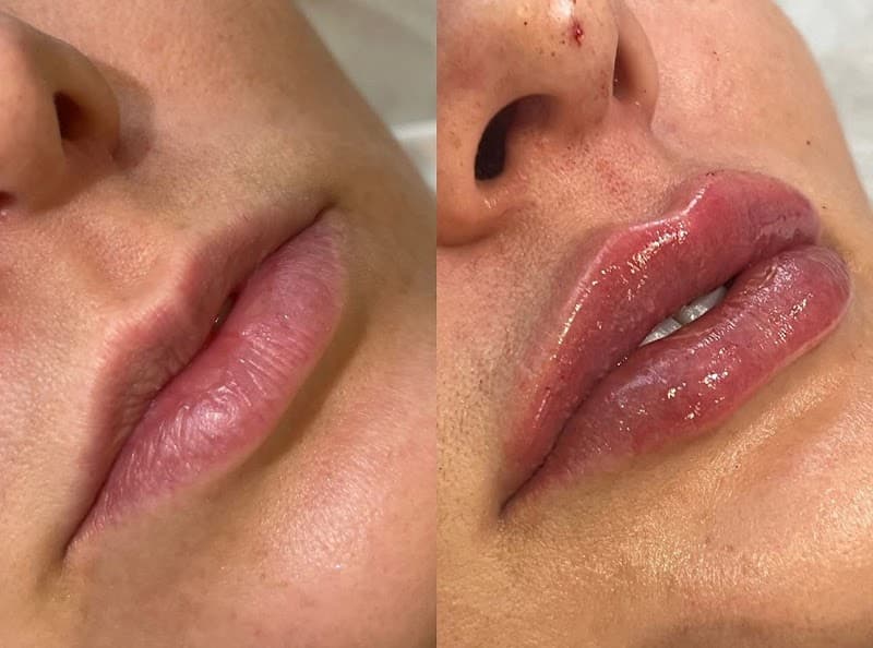 Estética Carol Santaguita Bauru photo
