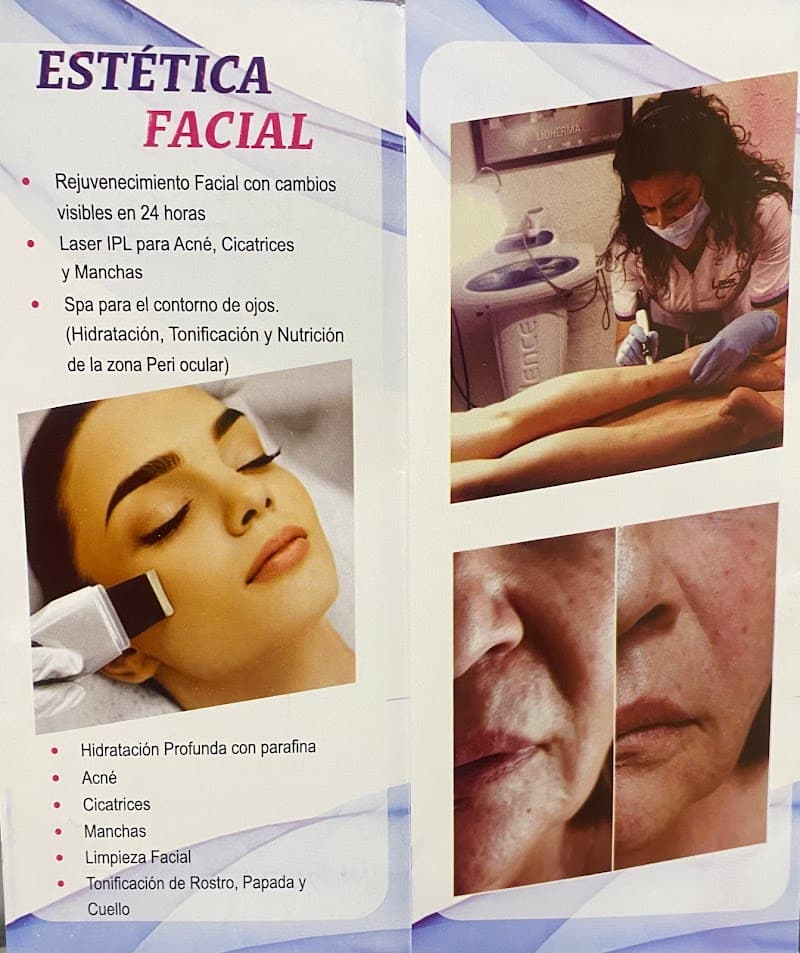 Estética-Centro de Estetica Imagen Spa Armenia photo