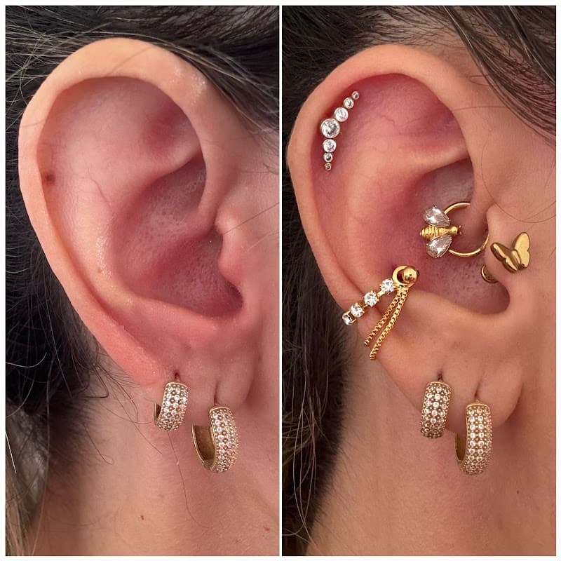 Estética Corporal Feminina Monte Alto photo