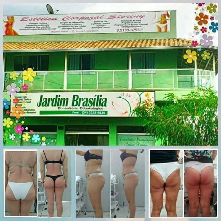 Estética Corporal Storiny Uberlândia photo