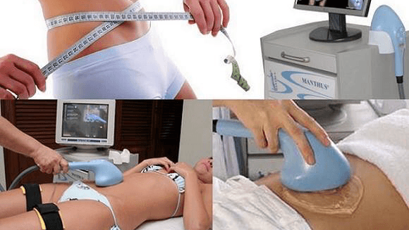 Estética Esbelty Ponta Grossa photo