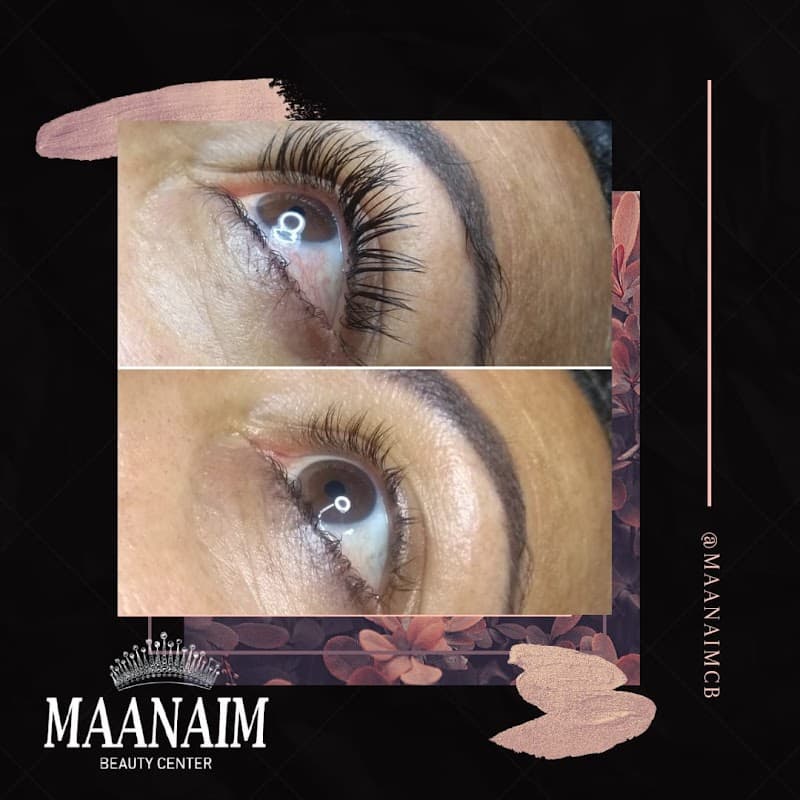 Estética Maanaim Goiânia photo