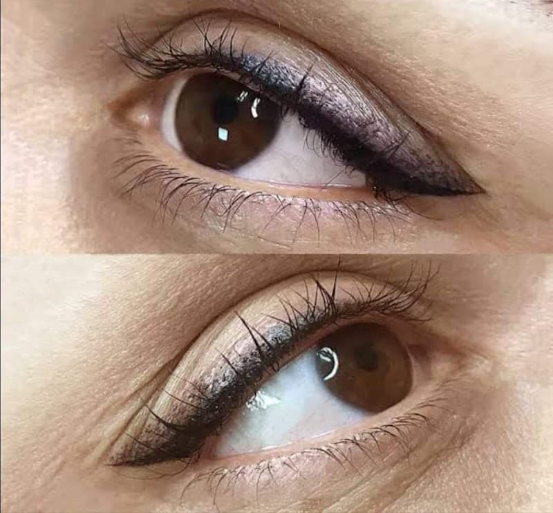 Estética Profesional MV Beauty Ica photo