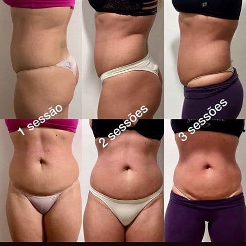 Estetica spa mademoiselle Rio Grande photo