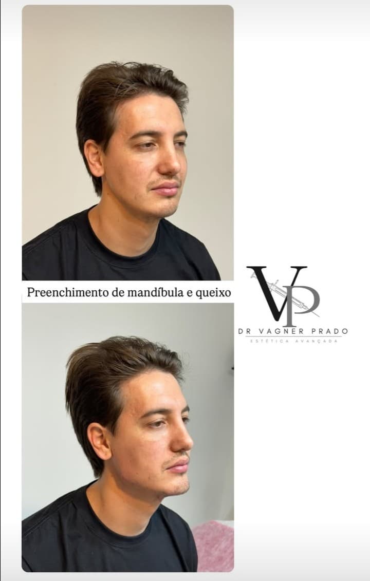 Estética Vagner Prado Itapema photo