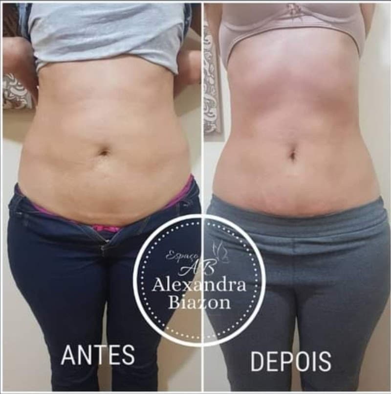 Esteticista Alexandra Biazon Rio Brilhante photo