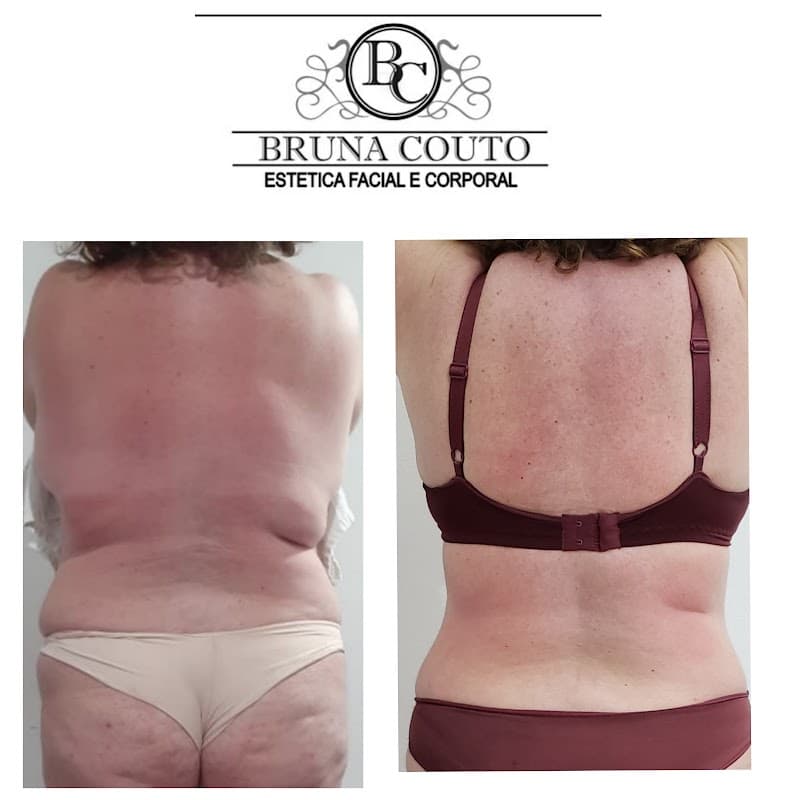 Esteticista Bruna Couto Campinas photo