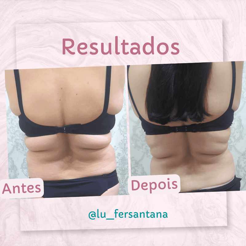 Esteticista Luiza Santana Campo Mourão photo