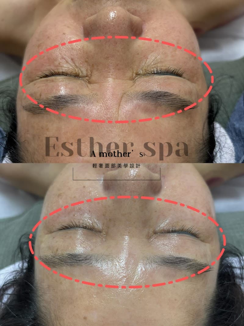 Esther Beauty Body Center Douliu City photo