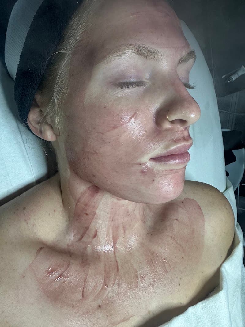 Esthetics by mallory Chesnee photo