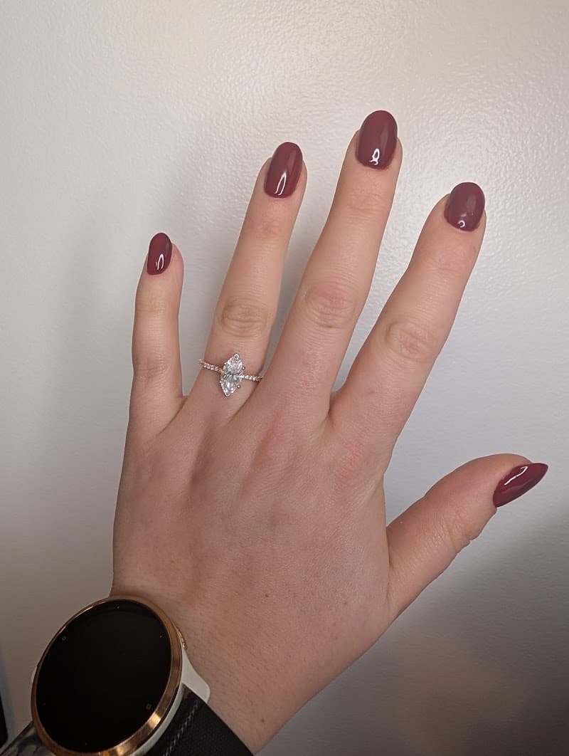 Esthetics By Nina Greater Sudbury photo