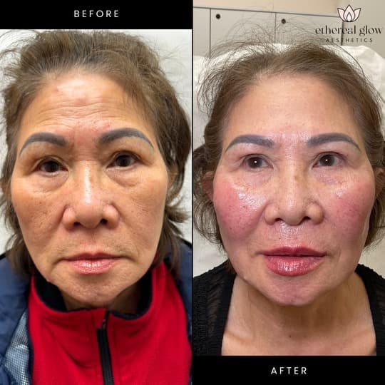 Ethereal Glow Esthetics Lounge Elon photo