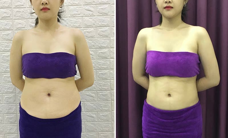 EvaCare Bấm Huyệt Giảm Mỡ Thủ Dầu Một photo
