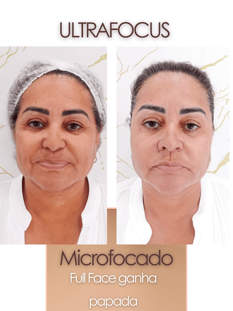 Evellyn Flor da Pele Estética e Centro de Beleza São Bernardo do Campo photo