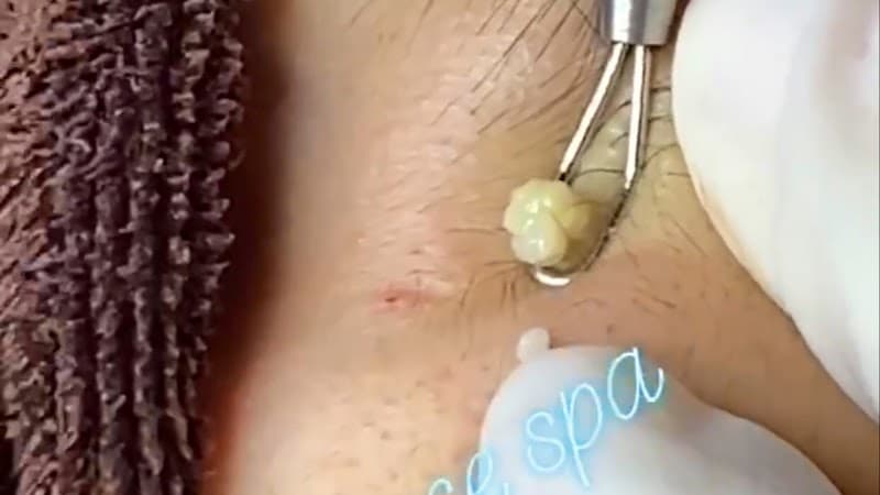 Excellence Spa | Siem Reap Krong Siem Reap 17254 photo