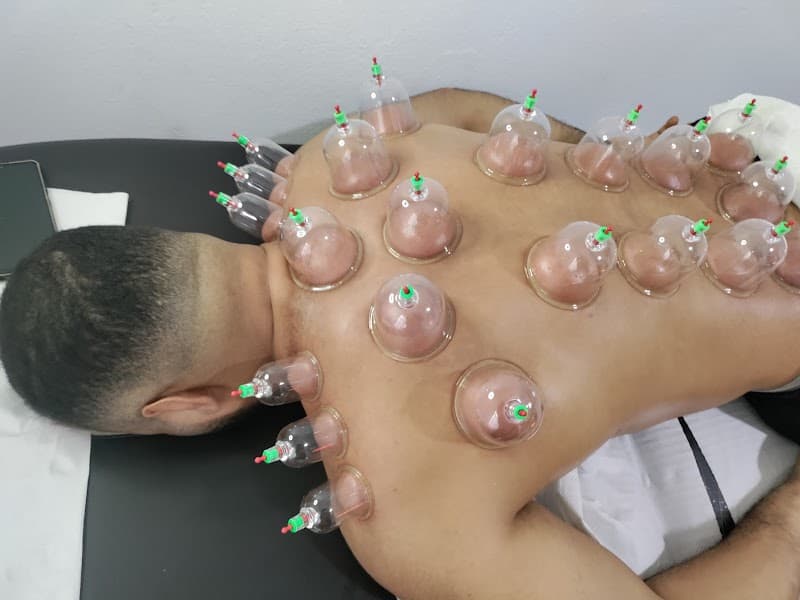 Experts in Hijama Hay Al Ghazala - Ariana photo