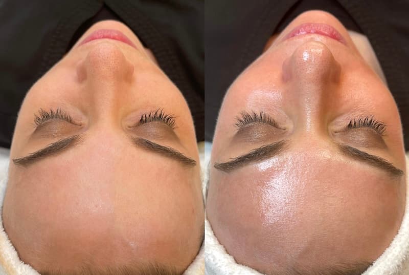 Face and Body by Lalita Palmetto Bay photo