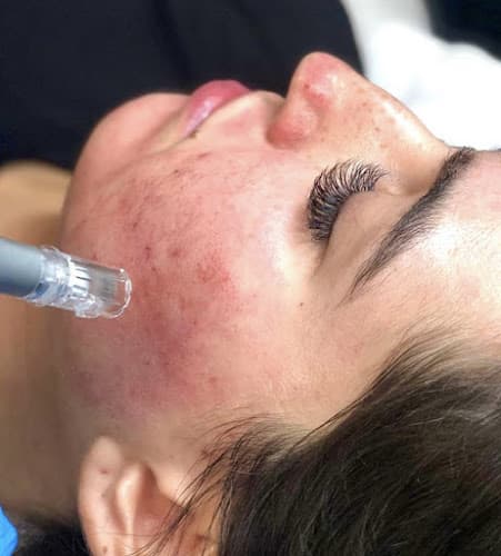 Face Halo Skincare and Aesthetics Belize City photo
