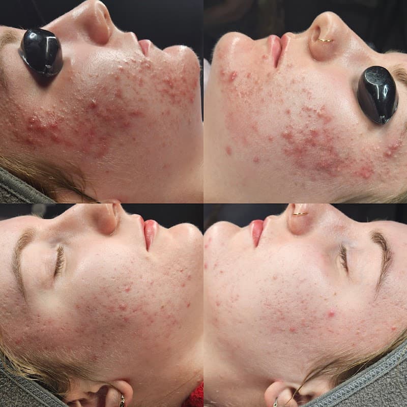 FACE It Skincare Therapy Buffalo photo