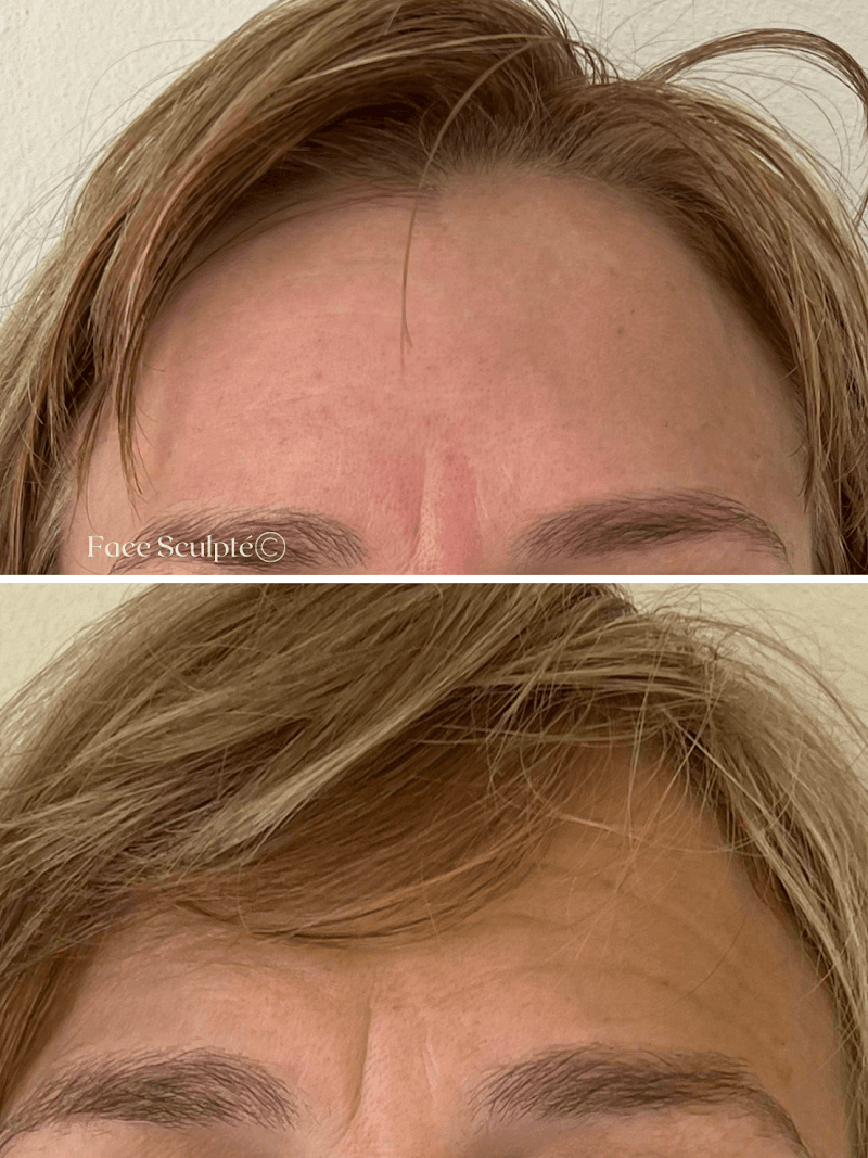 Face Sculpte Sydney photo