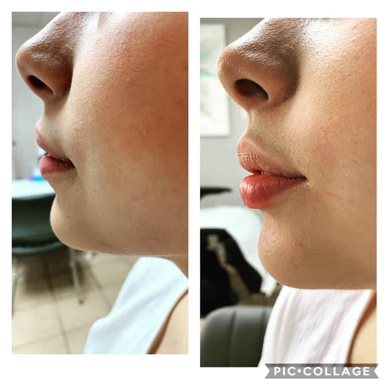 Faceness Medical Spa Mexicali photo