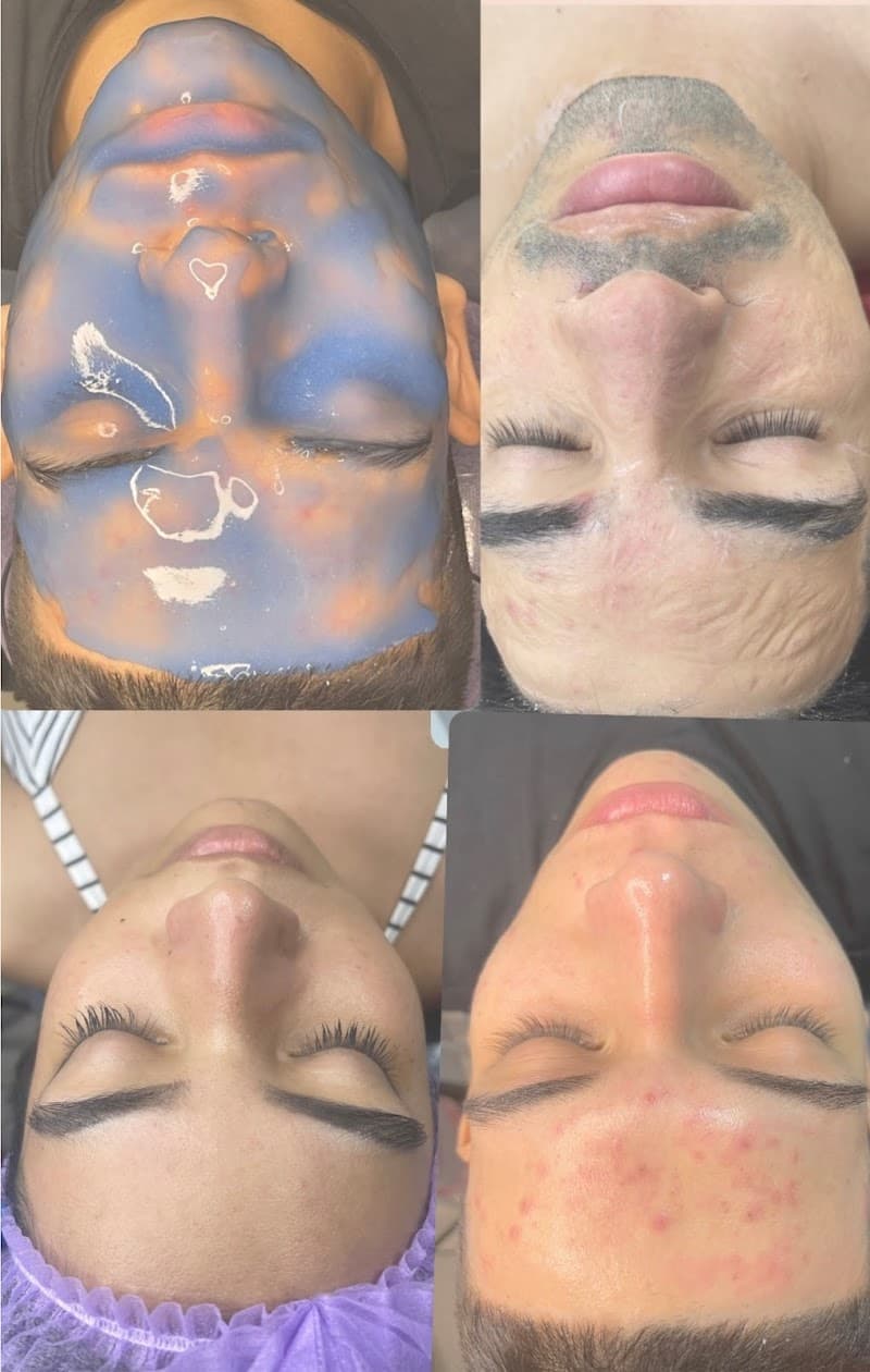 Facial Care Villavicencio photo