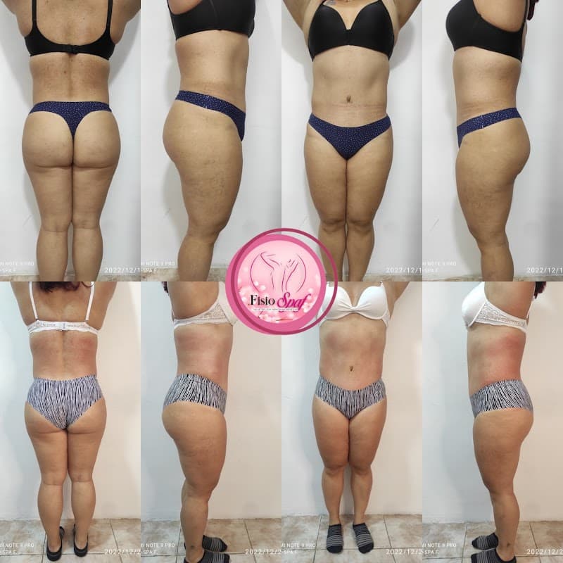 Fisio-spa figueredo F.P Guacara photo