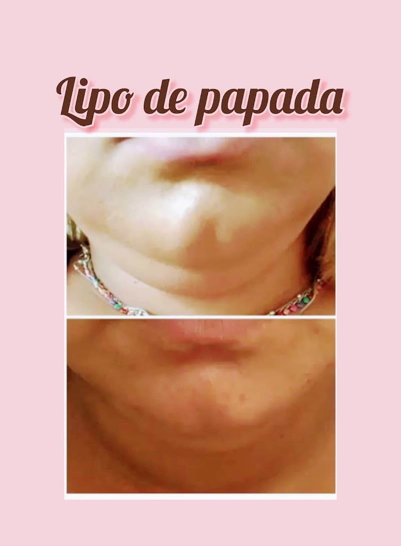 Fisioterapia Dermato-funcional e Estética Michelle Baraldi Fadel Conchal photo