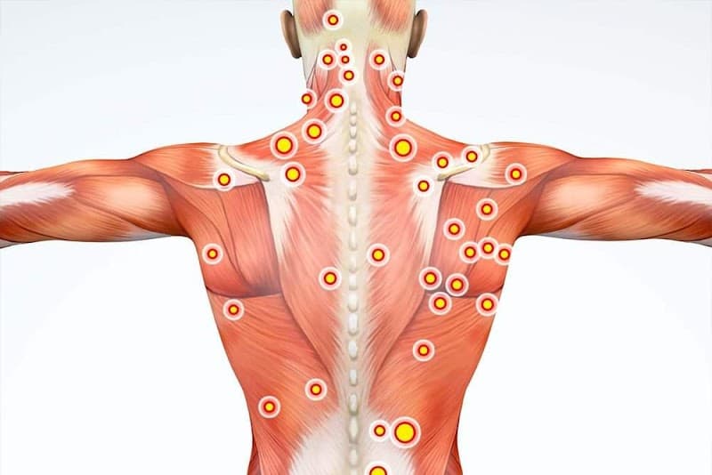 Fix and Heal Remedial Massage and Dry Needling Clinic Sunshine Coast photo