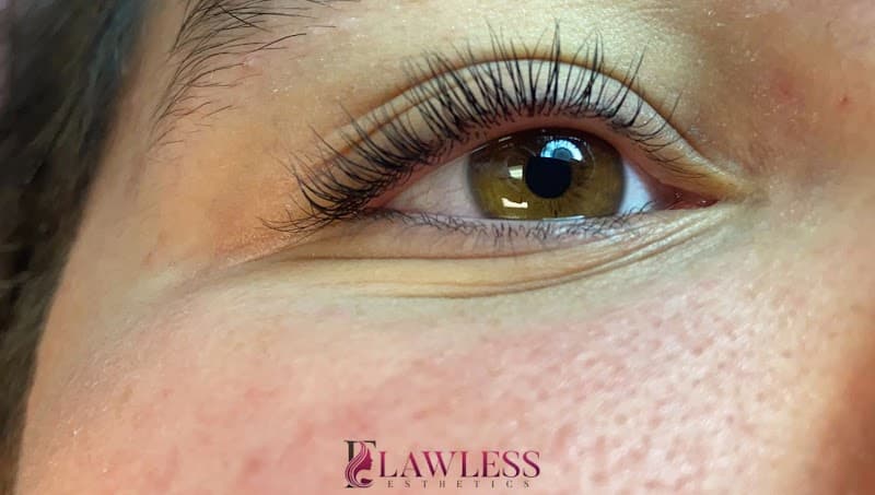 Flawless Esthetics Rupert photo